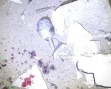 В Донецкой области от взрыва погиб спасатель-сапер, ранены трое полицейских
