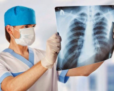 Заболеваемость туберкулезом в Украине за месяц резко возросла