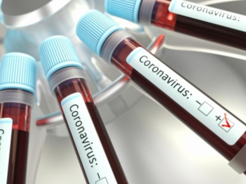 В Донецкой области подтверждено 6 случаев заражения коронавирусом