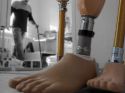 Авдіївці з інвалідністю зможуть потрапити на прийом до протезиста (ГРАФІК)