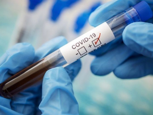 В Украине появятся новые бесплатные экспресс-тесты на коронавирус
