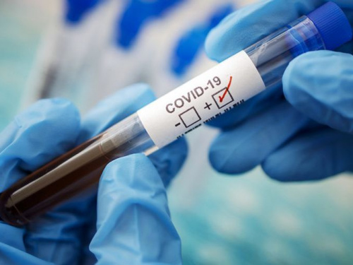 Семейные доктора в Украине будут тестировать пациентов на коронавирус