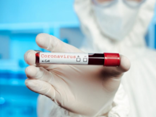 В Донецкой области новый антирекорд инфицированных коронавирусом за сутки