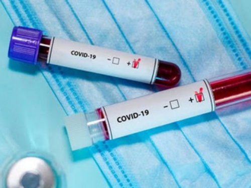 З початку пандемії в Авдіївці зареєстровано 168 випадків COVID-19