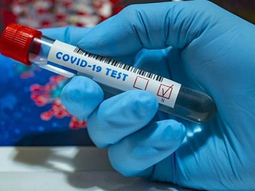 Четвертые сутки подряд антирекорд: в Украине за сутки 1 489 заболевших коронавирусом