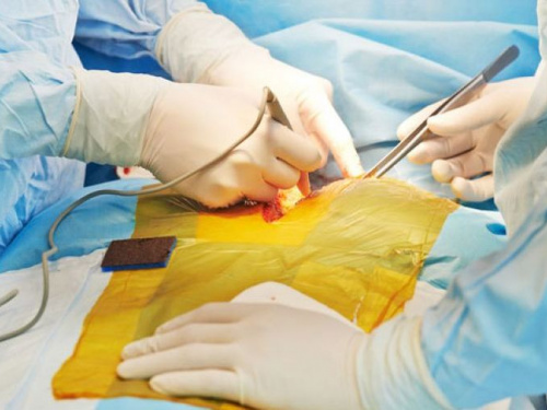Рада ухвалила закон про трансплантацію