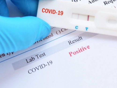 Кабмин выделил средства на закупку 2 млн экспресс-тестов на коронавирус