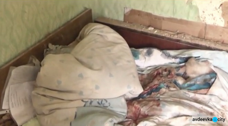В Авдеевку вернулась девушка, потерявшая ногу во время обстрела (ФОТО + ВИДЕО)