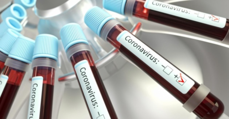 В Донецкой области подтверждено 6 случаев заражения коронавирусом