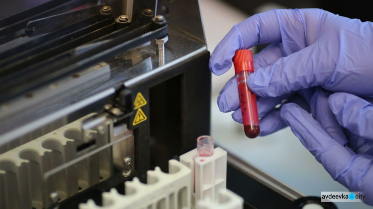 Ученые выяснили, какая группа крови меньше всего склонна к онкологии