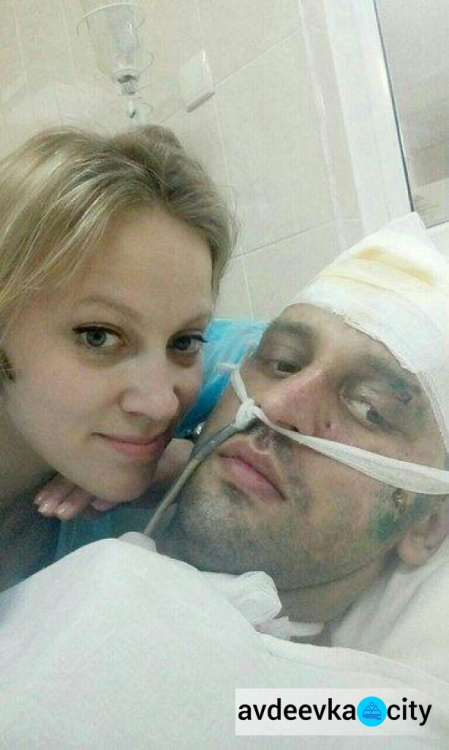 Раненый в мае авдеевец Артем Чураков идет на поправку (ФОТО)