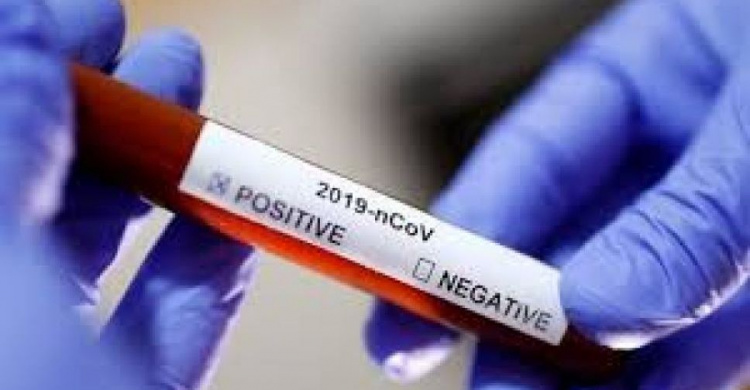 Учителей Авдеевки не будут тестировать на коронавирус перед 1 сентября