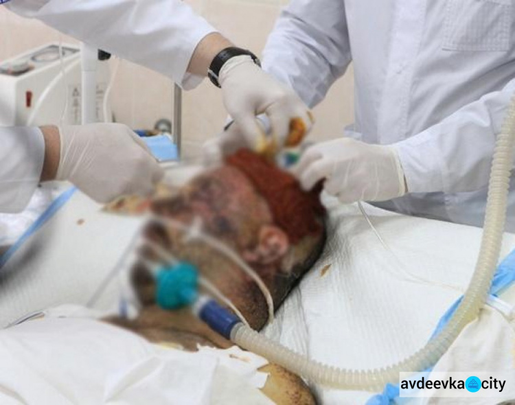Главврач Днепровской областной больницы шокирован травмами раненого в Авдеевке Артема Чуракова (ФОТО)