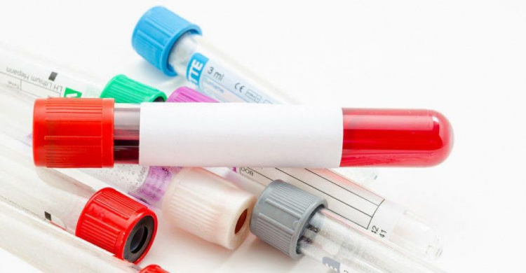 ВИЧ и СПИД: как в Авдеевке пройти анонимное бесплатное тестирование