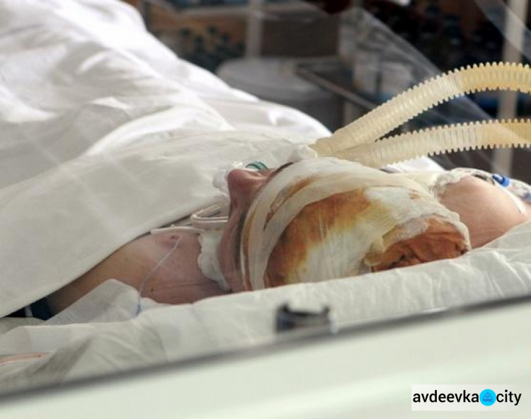Главврач Днепровской областной больницы шокирован травмами раненого в Авдеевке Артема Чуракова (ФОТО)