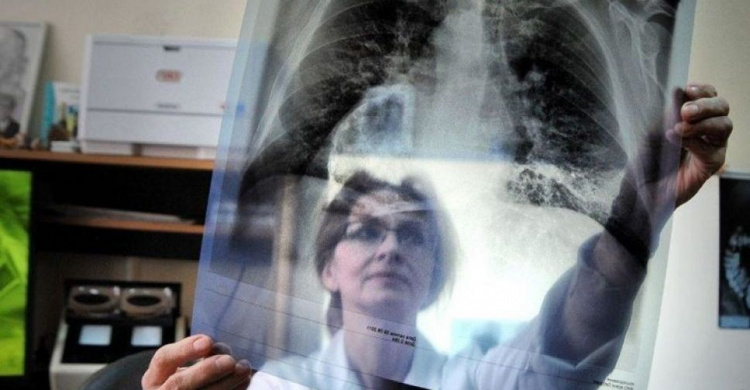 В Украине зарегистрировали инновационное лекарство от туберкулеза