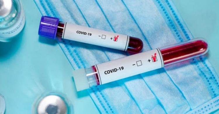 З початку пандемії в Авдіївці зареєстровано 168 випадків COVID-19