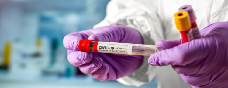 В Україні починається нова хвиля коронавірусу