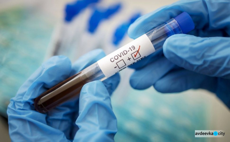 В Украине появятся новые бесплатные экспресс-тесты на коронавирус