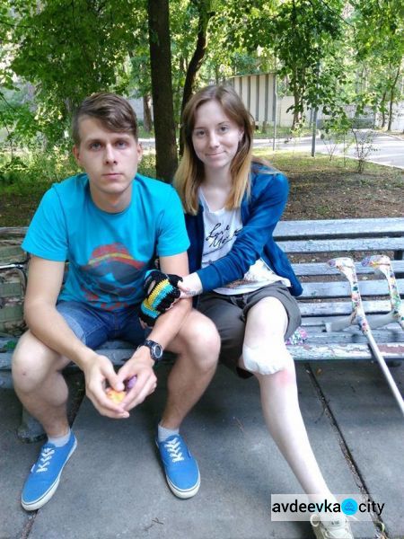 Ольга потеряла в Авдеевке ногу и нашла любовь (ФОТО)