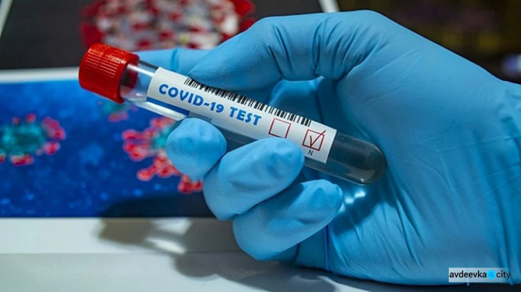 Четвертые сутки подряд антирекорд: в Украине за сутки 1 489 заболевших коронавирусом
