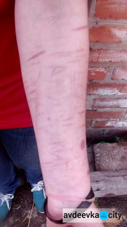 Четырнадцатилетняя жительница Донецкой области попала в "группу смерти" и изрезала себя
