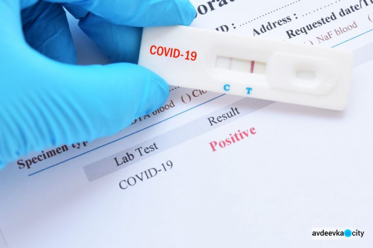Кабмин выделил средства на закупку 2 млн экспресс-тестов на коронавирус