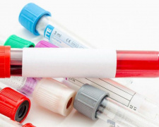 ВИЧ и СПИД: как в Авдеевке пройти анонимное бесплатное тестирование