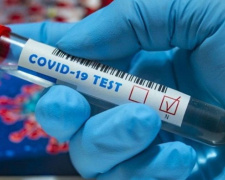 В Авдеевке лабораторно подтверждены 67 случаев COVID-19