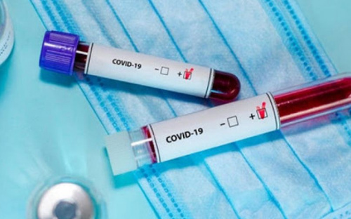 З початку пандемії в Авдіївці зареєстровано 168 випадків COVID-19