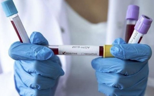 Эпидемия коронавирусной инфекции снова начинает набирать обороты в Украине
