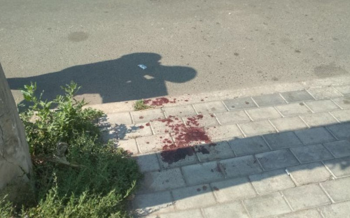 В Авдеевке произошло очередное ДТП: пострадал велосипедист (ФОТОФАКТ)