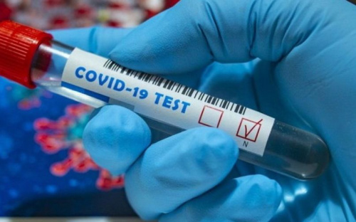 В Авдеевке лабораторно подтверждены 67 случаев COVID-19