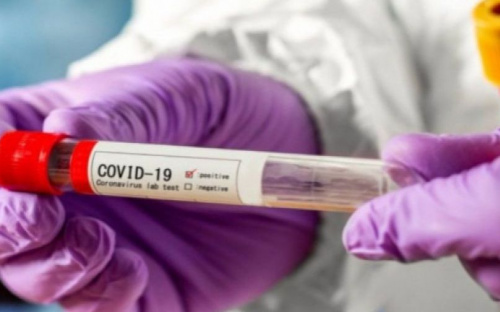 Тестирование на COVID-19 намерены сделать бесплатным