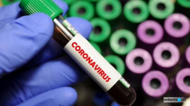 В Британии нашли еще более заразный вариант коронавируса, чем "Дельта", - FT