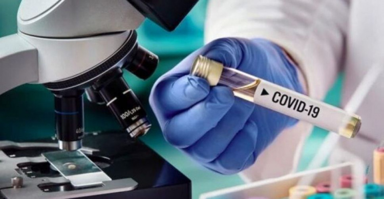 В Украине появится собственный препарат против коронавируса